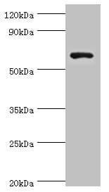 Polyclonal Rabbit anti-Human GAD1 / GAD67 Antibody (aa1-200, IHC, WB)