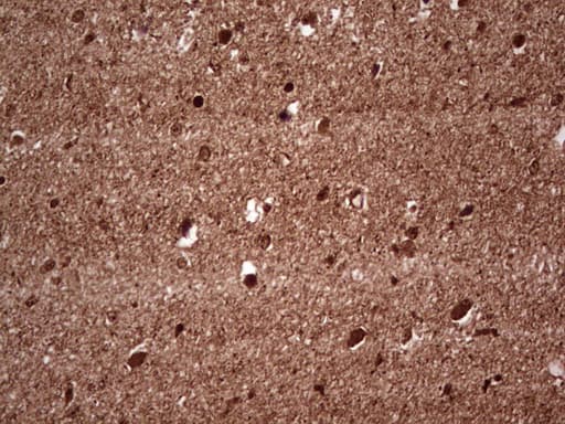 Monoclonal Mouse anti-Human NEFM / NF-M Antibody (clone OTI2G3, aa413-773, IHC, WB)