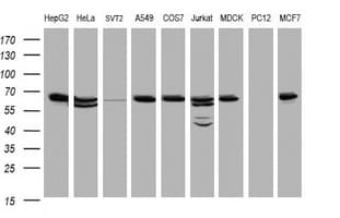 PathPlus™ HSPD1 / HSP60 Antibody (clone OTI3A2)