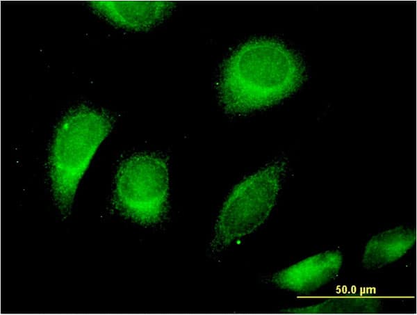 Monoclonal Mouse anti-Human CLCN6 Antibody (clone 2H2, IF, WB)