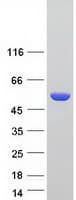 Human ALDH3A1 Protein (Recombinant Myc-DDK (Flag))