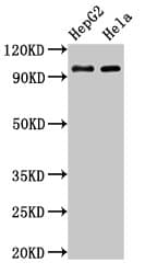 ACO1 / Aconitase Antibody