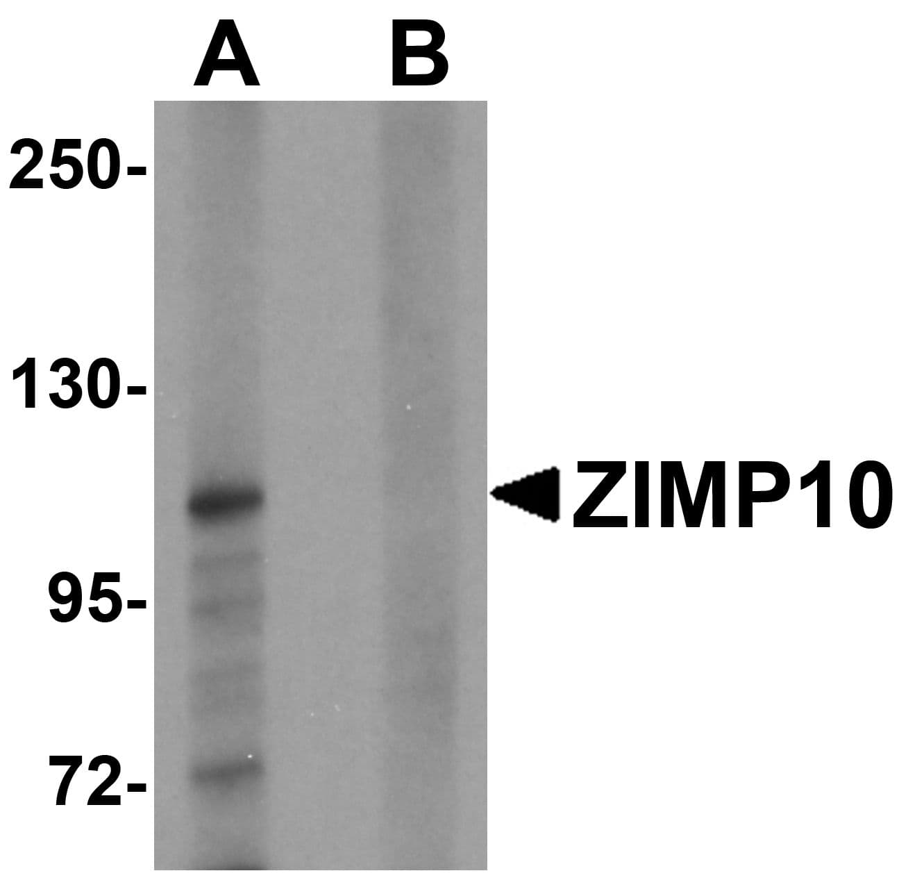 ZMIZ1 Antibody