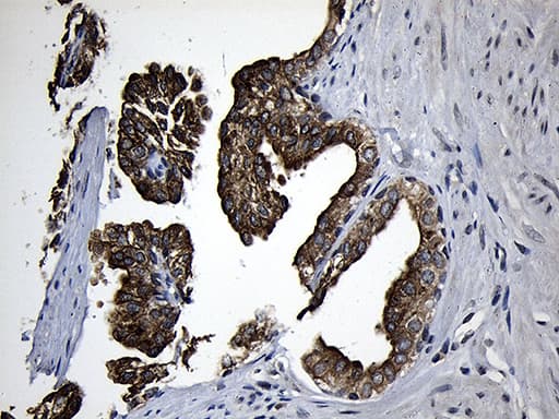 CPT1B Antibody (aa187-440, clone OTI2A6)