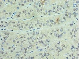 CSTF2 / CstF-64 Antibody (aa1-180)