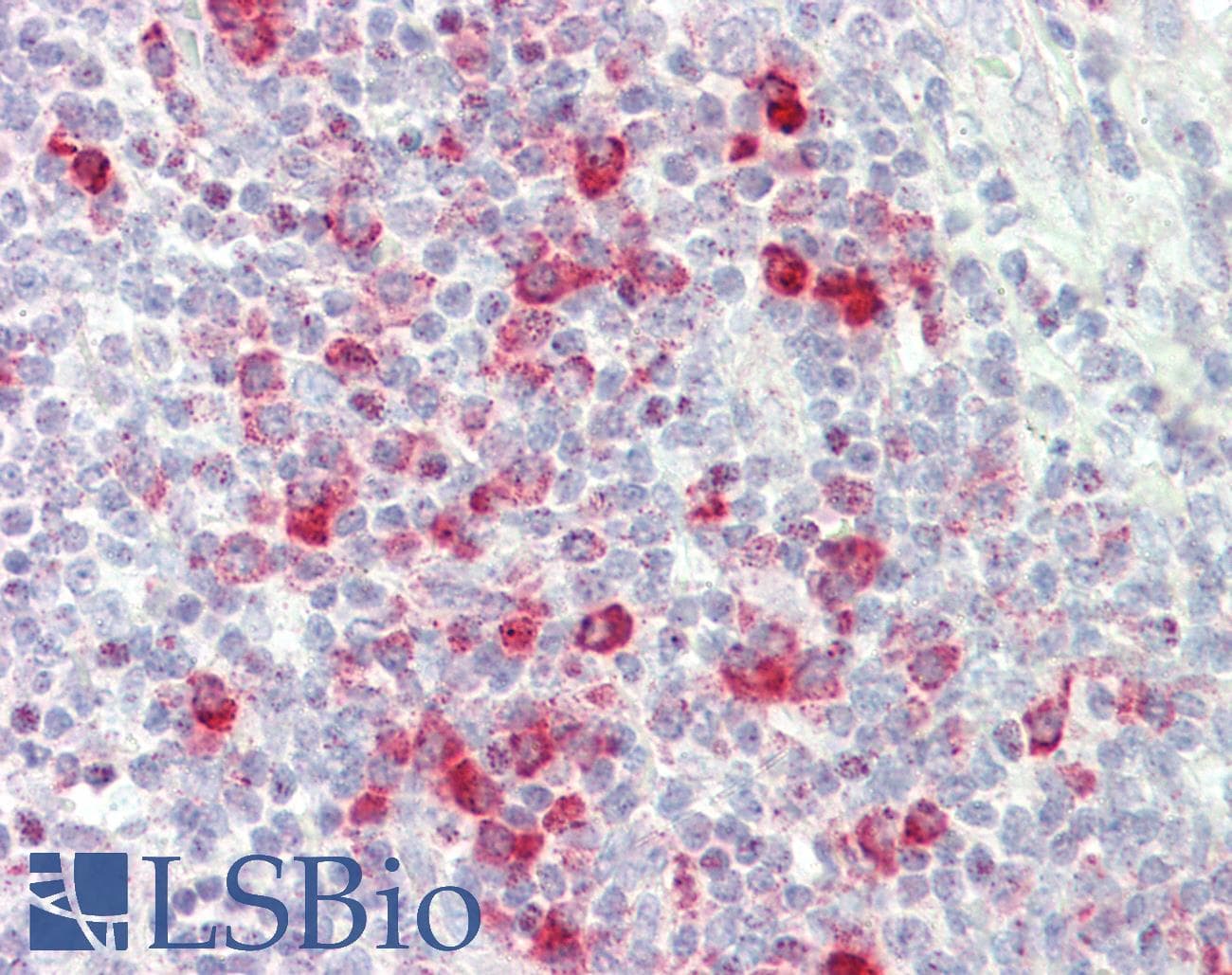 IHC-plus™ Polyclonal Rabbit anti-Human FZD5 / Frizzled 5 Antibody (aa461-510, IHC, IF, WB)