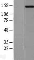 PCDH11Y / Protocadherin Y Protein (Over-Expression Lysate Myc-DDK (Flag))