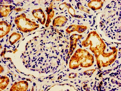 Polyclonal Rabbit anti-Human LACE1 Antibody (IHC, WB)