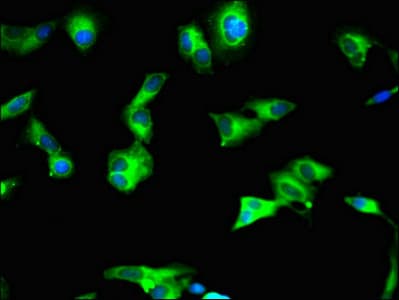 SIRT2 / Sirtuin 2 Antibody