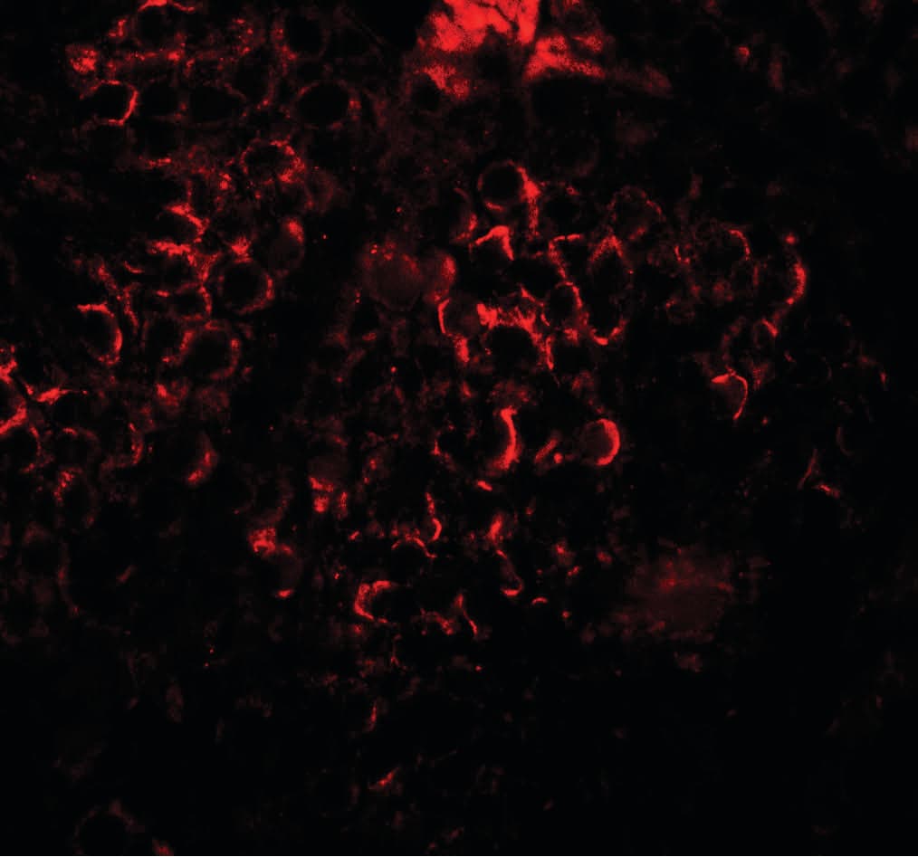 IHC-plus™ Polyclonal Rabbit anti-Human DCP2 Antibody (IHC, IF, WB)