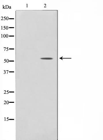 Polyclonal Rabbit anti-Human NR1A2 / THRB Antibody (IHC, IF, WB)