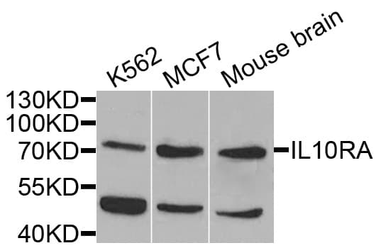 IL10RA Antibody