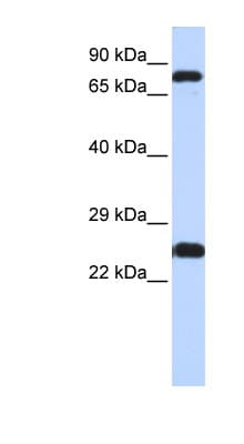 ZNF799 Antibody (aa111-160)