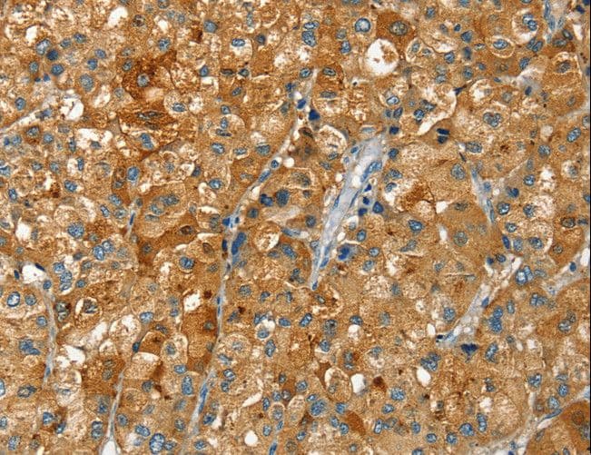 RAB25 Antibody