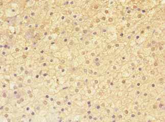 ADAMTSL4 Antibody