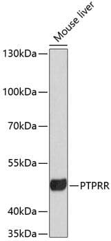 Polyclonal Rabbit anti-Human PTPRR Antibody (WB)