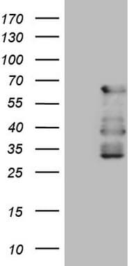CAMK2B / CaMKII Beta Antibody (aa311-385, clone OTI4B12)