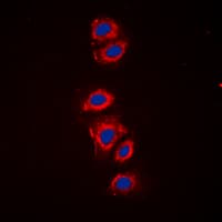 RPS6 / Ribosomal Protein S6 Antibody (C-Terminus)