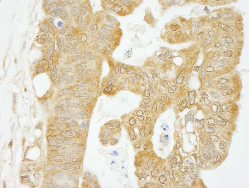 EIF4G1 / EIF4G Antibody (aa525-575)