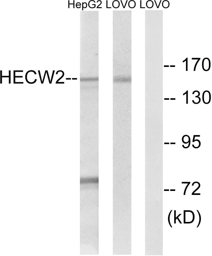 NEDL2 / HECW2 Antibody (aa481-530)