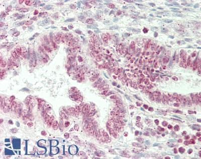 ST6GALNAC1 Antibody (aa396-445)