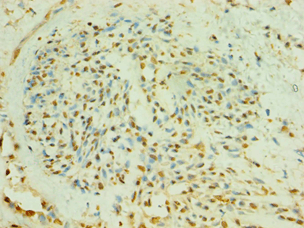 BLK Antibody (aa1-280)