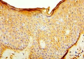 Polyclonal Rabbit anti-Human IL7R / CD127 Antibody (aa21-239, IHC, WB)