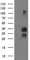 UBE2J1 Antibody (clone OTI2D4)