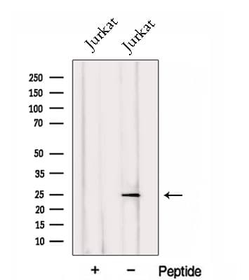 PSMC3IP Antibody