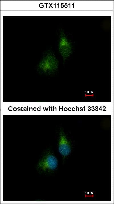 Polyclonal Rabbit anti-Human PDIA5 / PDIR Antibody (aa1-253, IHC, WB)