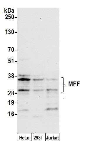 MFF Antibody (aa100-150)