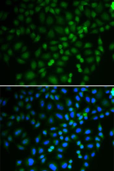 TRIM21 / RO52 Antibody