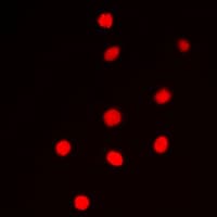 CCNE1 / Cyclin E1 Antibody (Internal)