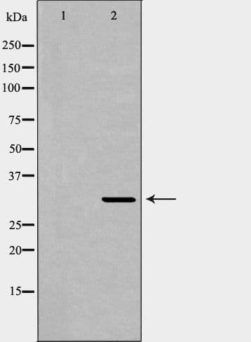 Polyclonal Rabbit anti-Human XRCC2 Antibody (IHC, WB)