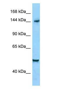 DIAPH1 Antibody (aa1196-1245)