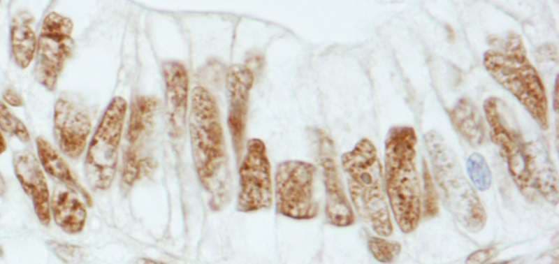 Polyclonal Rabbit anti-Human RBBP5 Antibody (aa500-C-term, IHC, WB)