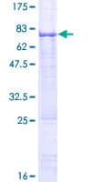 Human HSFY1 Protein (Recombinant GST)