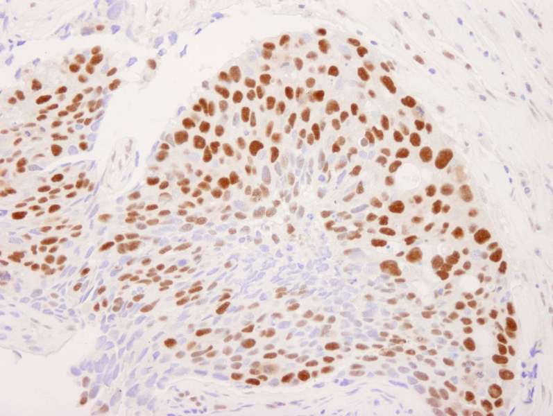 IHC-plus™ RCOR1 / COREST Antibody (aa425-C-term)