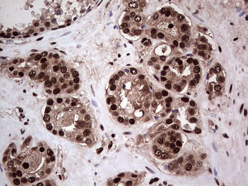 Monoclonal Mouse anti-Human SAE1 Antibody (clone OTI6B11, Carrier-free, IHC, WB)