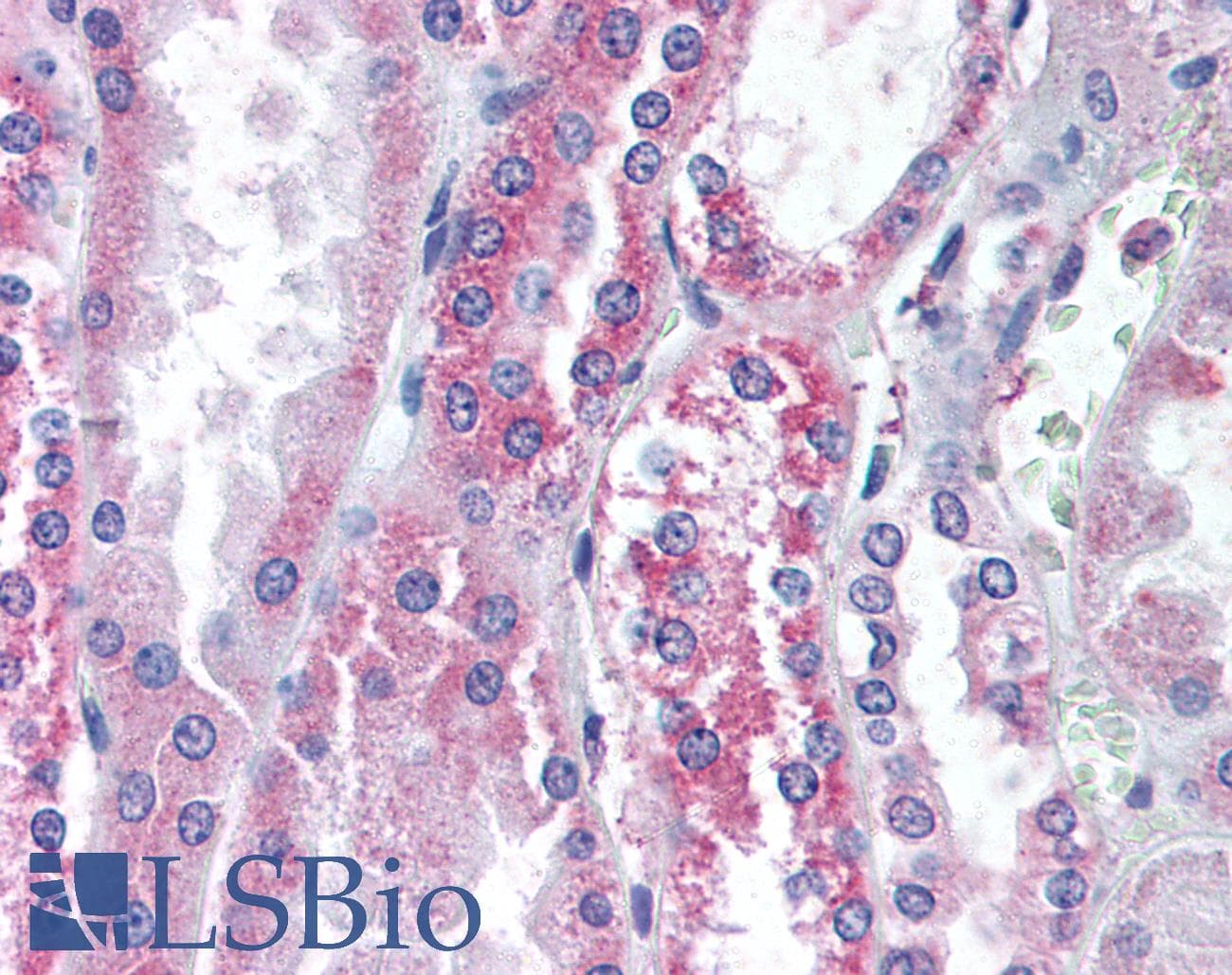 PathPlus™ Polyclonal Rabbit anti-Human VR1 / TRPV1 Antibody (Internal, IHC)