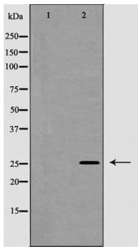 NGF Antibody