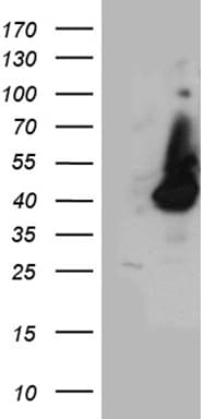 Polyclonal Rabbit anti-Human HPR Antibody (WB)