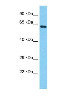 POTEB3 / POTE-15 Antibody (aa439-488)