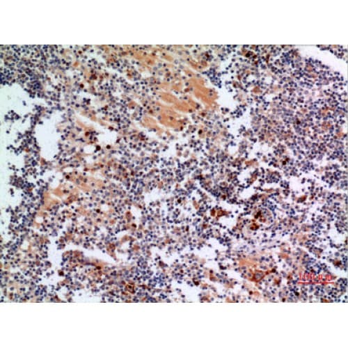 Polyclonal Rabbit anti-Human CYBB / NOX2 / gp91phox Antibody (Internal, IHC, WB)