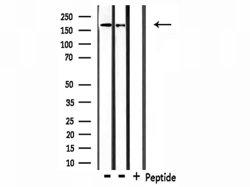 COL4A1 / Collagen IV Alpha1 Antibody