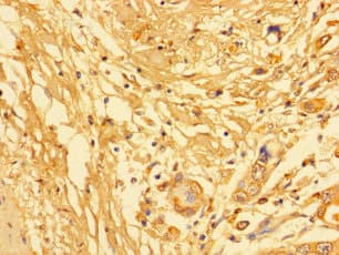 KLK6 / Kallikrein 6 Antibody