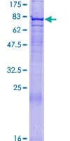 Human FBXO24 Protein (Recombinant GST)