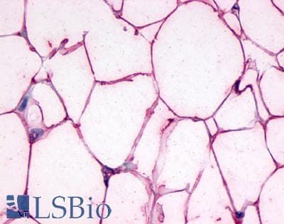 PathPlus™ GCGR / Glucagon Receptor Antibody (Extracellular Domain)