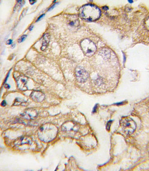 FLT4 / VEGFR3 Antibody (clone 44CT92.4.4)