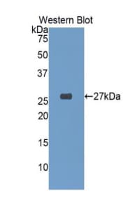 GSTA4 Antibody (aa3-222, FITC)